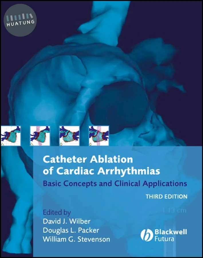 Catheter Ablation of Cardiac Arrhythmias 
